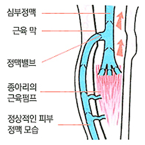 정상적인 정맥 모습